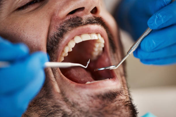 Best Emergency Dental Care for Broken or Chipped Teeth in Lake Hallie, WI