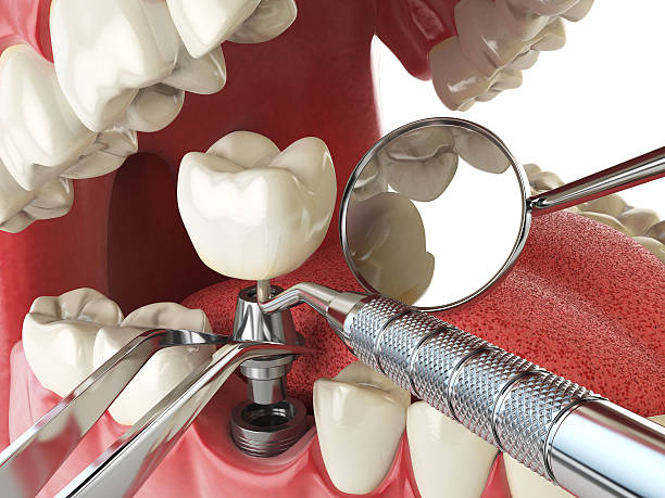 Best Emergency Denture Repair in Lake Hallie, WI